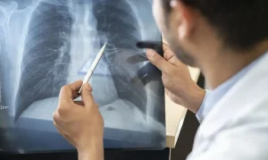 Anvisa aprova novo medicamento para câncer de pulmão e amplia opções de tratamento para câncer de mama